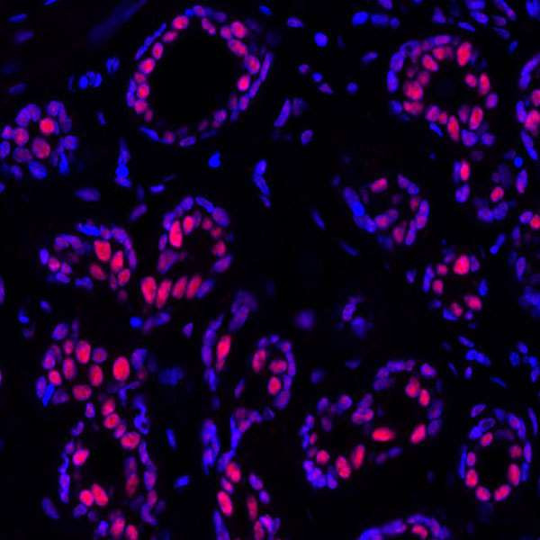 PBRM1 Antibody in Immunohistochemistry (Paraffin) (IHC (P))