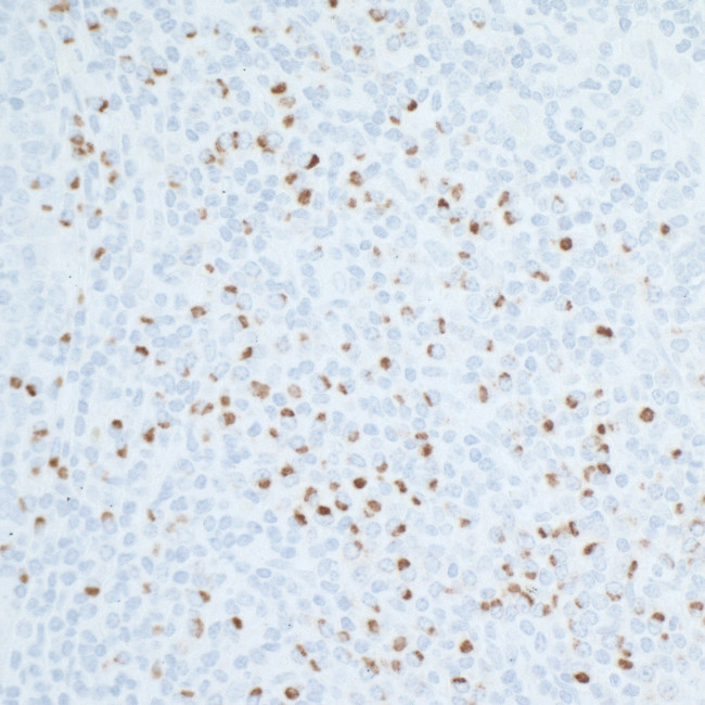 CD86 Antibody in Immunohistochemistry (Paraffin) (IHC (P))