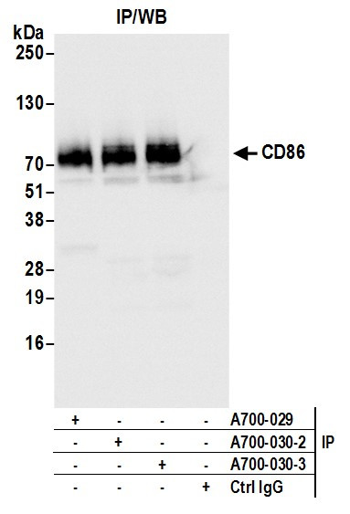 CD86 Antibody in Immunoprecipitation (IP)