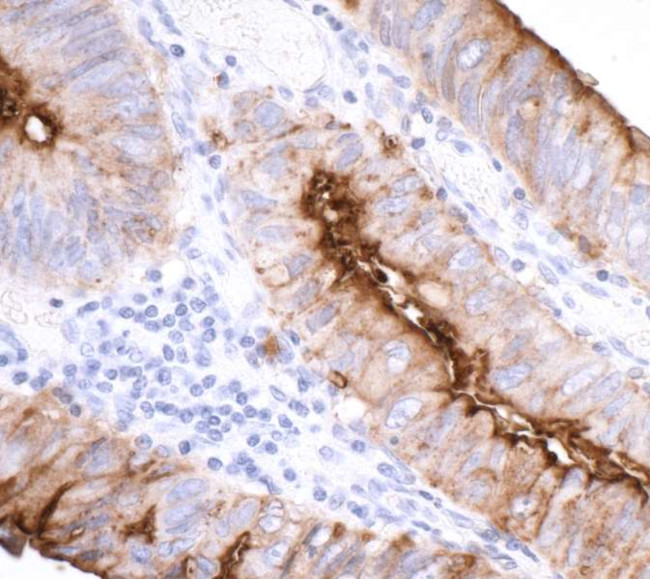 CEACAM1 Antibody in Immunohistochemistry (Paraffin) (IHC (P))