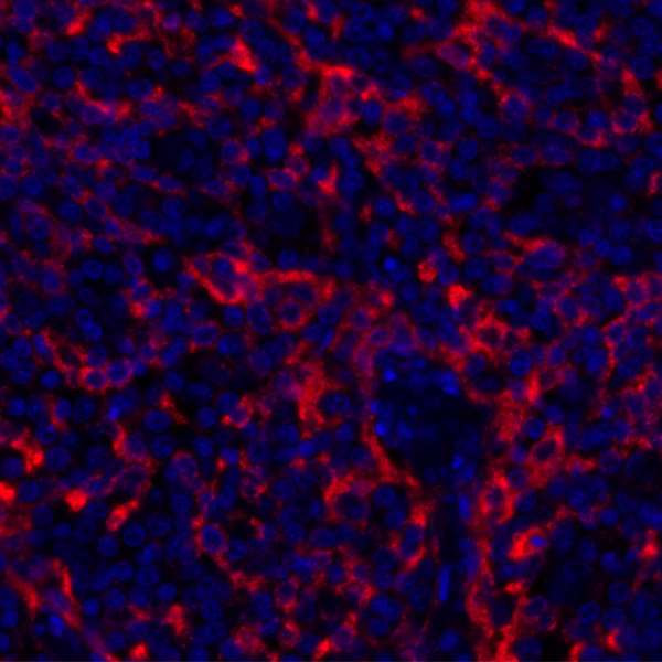 TIM3 Antibody in Immunohistochemistry (Paraffin) (IHC (P))