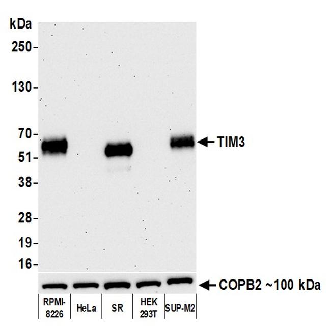 TIM3 Antibody in Western Blot (WB)