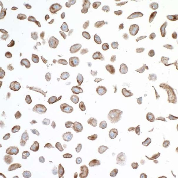 VISTA Antibody in Immunocytochemistry (ICC/IF)