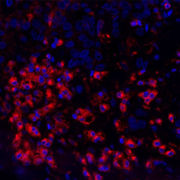 VISTA Antibody in Immunohistochemistry (Paraffin) (IHC (P))