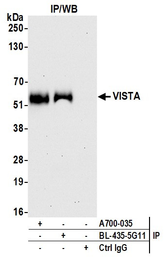 VISTA Antibody in Immunoprecipitation (IP)