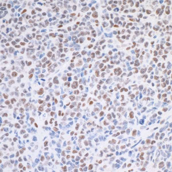 MED1 Antibody in Immunohistochemistry (Paraffin) (IHC (P))