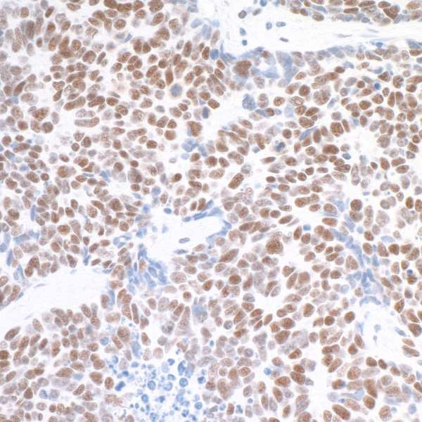 MED1 Antibody in Immunohistochemistry (Paraffin) (IHC (P))