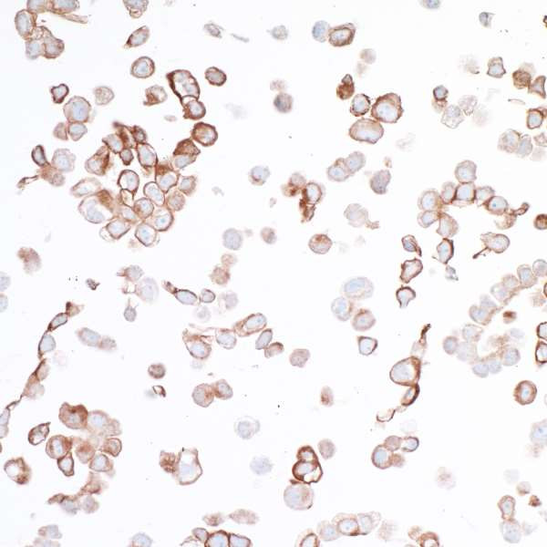 B7-H4 Antibody in Immunocytochemistry (ICC/IF)