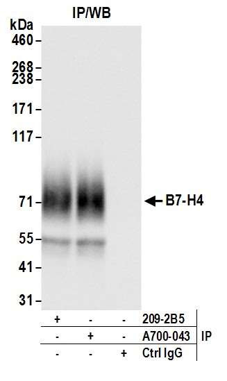 B7-H4 Antibody in Immunoprecipitation (IP)