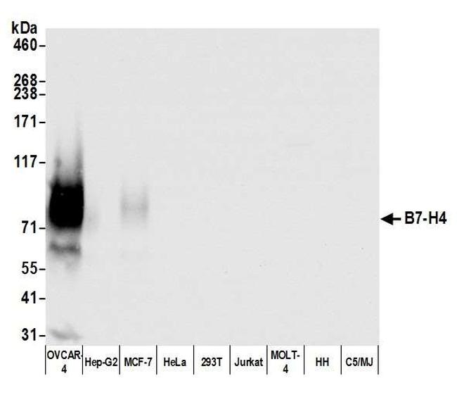 B7-H4 Antibody in Western Blot (WB)