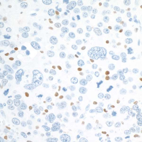 c-Maf Antibody in Immunohistochemistry (Paraffin) (IHC (P))