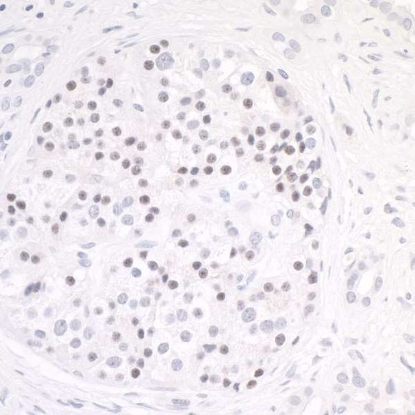 MafB Antibody in Immunohistochemistry (Paraffin) (IHC (P))