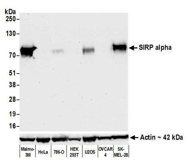 SIRP alpha Antibody in Western Blot (WB)