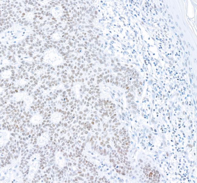 gamma-H2AX Antibody in Immunohistochemistry (Paraffin) (IHC (P))