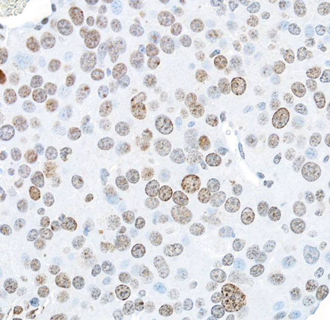 gamma-H2AX Antibody in Immunohistochemistry (Paraffin) (IHC (P))