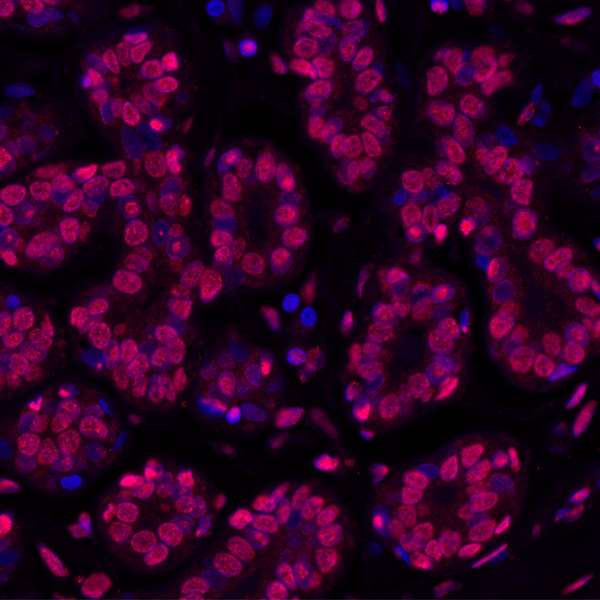 gamma-H2AX Antibody in Immunohistochemistry (Paraffin) (IHC (P))