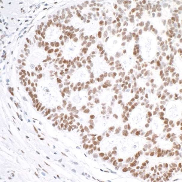 gamma-H2AX Antibody in Immunohistochemistry (Paraffin) (IHC (P))