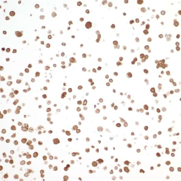 NAMPT/PBEF/Visfatin Antibody in Immunocytochemistry (ICC/IF)