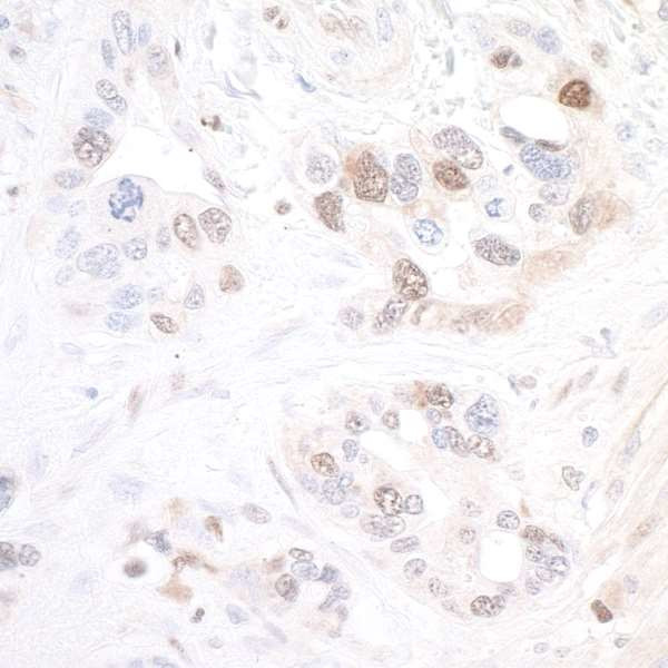 NAMPT/PBEF/Visfatin Antibody in Immunohistochemistry (Paraffin) (IHC (P))