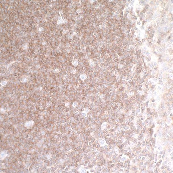 HVEM/TNFRSF14 Antibody in Immunohistochemistry (Paraffin) (IHC (P))