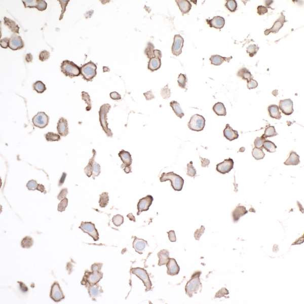 HVEM/TNFRSF14 Antibody in Immunocytochemistry (ICC/IF)