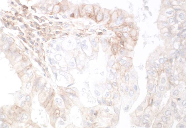 HVEM/TNFRSF14 Antibody in Immunohistochemistry (Paraffin) (IHC (P))