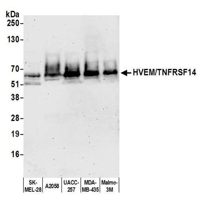 HVEM/TNFRSF14 Antibody in Western Blot (WB)