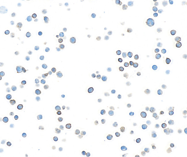 DNAM-1/CD226 Antibody in Immunocytochemistry (ICC/IF)