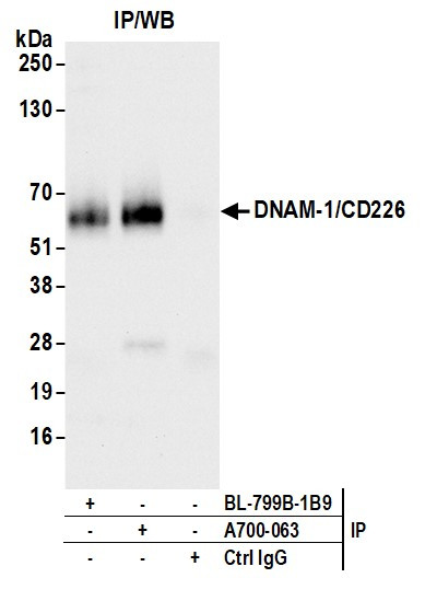 DNAM-1/CD226 Antibody in Immunoprecipitation (IP)