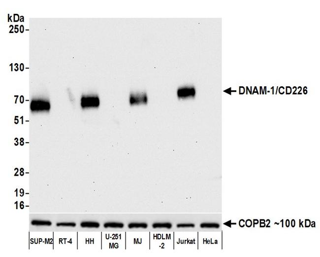 DNAM-1/CD226 Antibody in Western Blot (WB)