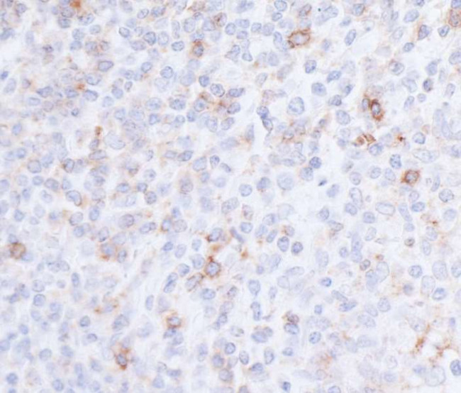 CD96 Antibody in Immunohistochemistry (Paraffin) (IHC (P))