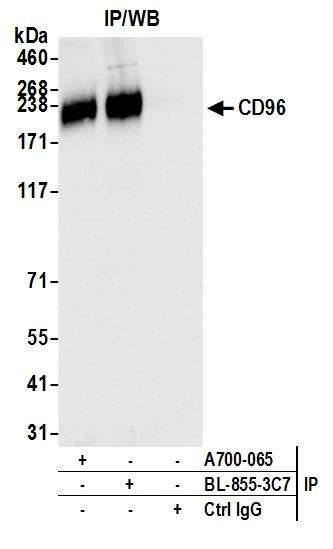 CD96 Antibody in Immunoprecipitation (IP)
