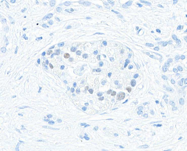 MafA Antibody in Immunohistochemistry (Paraffin) (IHC (P))