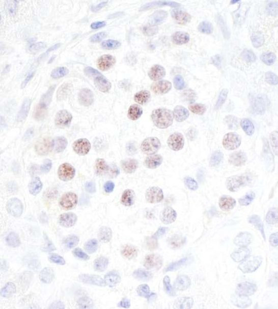 MafA Antibody in Immunohistochemistry (Paraffin) (IHC (P))