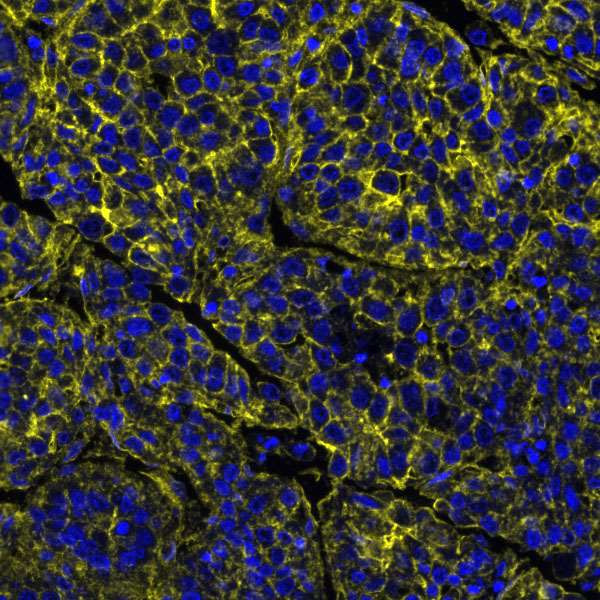 Nectin-2/CD112 Antibody in Immunohistochemistry (Paraffin) (IHC (P))