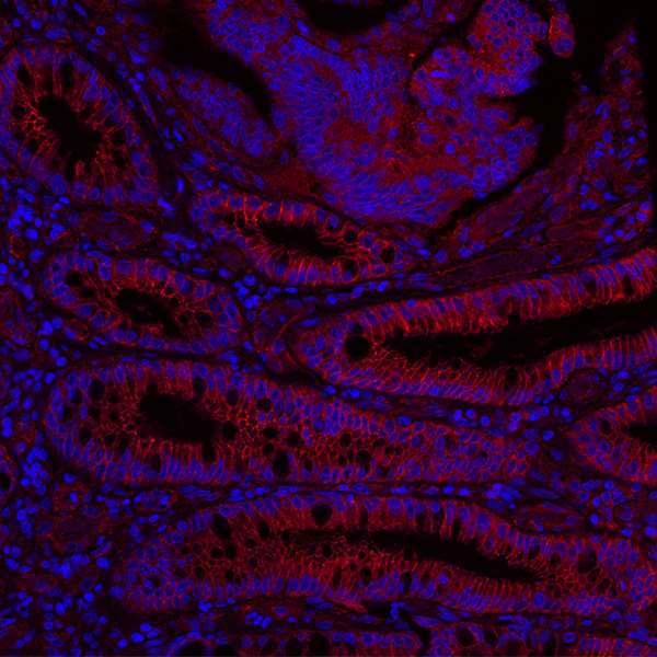 Nectin-2/CD112 Antibody in Immunohistochemistry (Paraffin) (IHC (P))