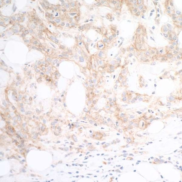 Nectin-2/CD112 Antibody in Immunohistochemistry (Paraffin) (IHC (P))