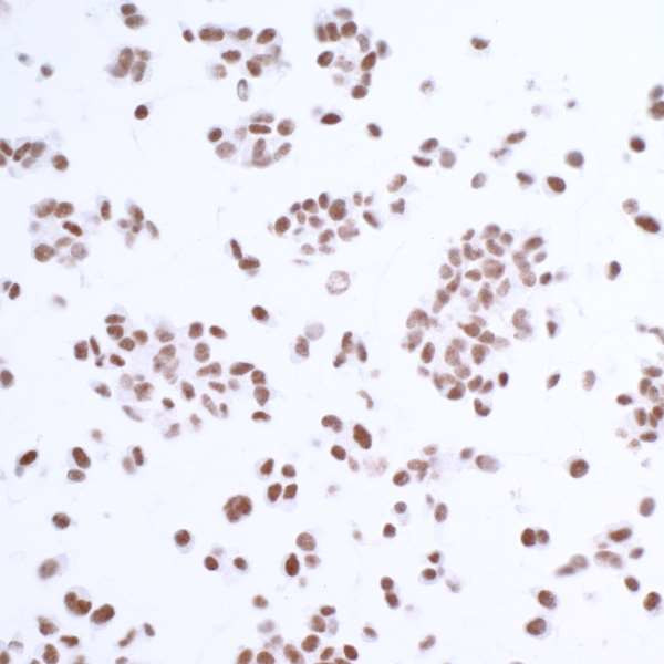 USP7/HAUSP Antibody in Immunocytochemistry (ICC/IF)