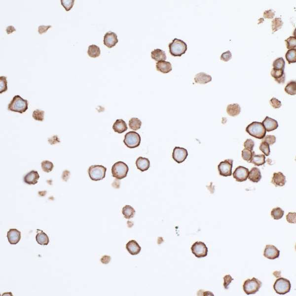 PVR/CD155 Antibody in Immunocytochemistry (ICC/IF)