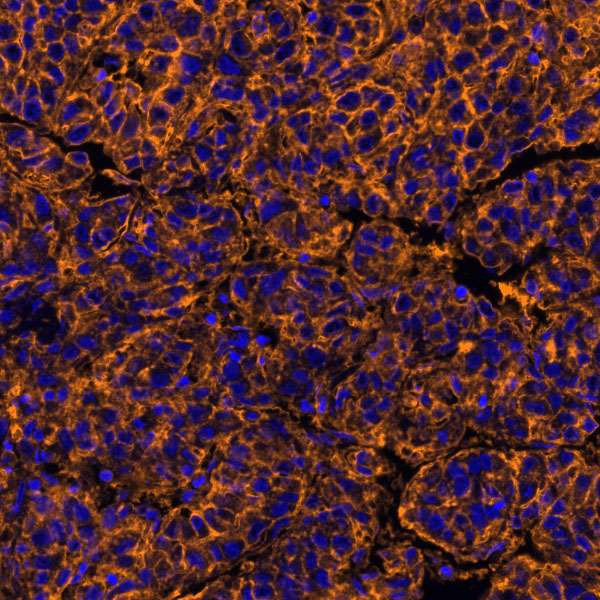 PVR/CD155 Antibody in Immunohistochemistry (Paraffin) (IHC (P))