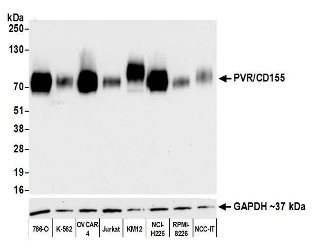 PVR/CD155 Antibody in Western Blot (WB)