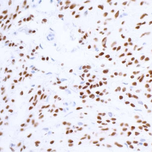 SOX10 Antibody in Immunohistochemistry (Paraffin) (IHC (P))