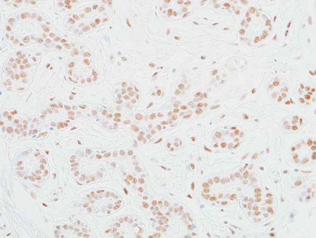 MED12 Antibody in Immunohistochemistry (Paraffin) (IHC (P))