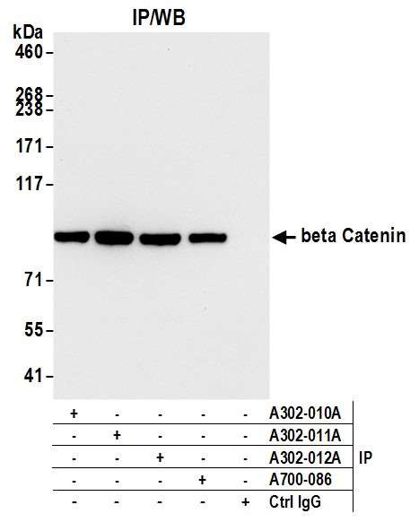 beta Catenin Antibody in Immunoprecipitation (IP)