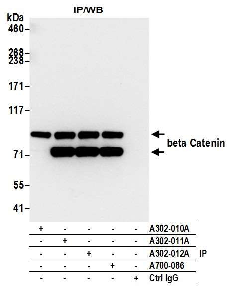 beta Catenin Antibody in Immunoprecipitation (IP)