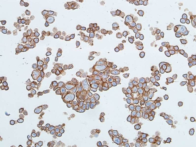 E-Cadherin Antibody in Immunocytochemistry (ICC/IF)