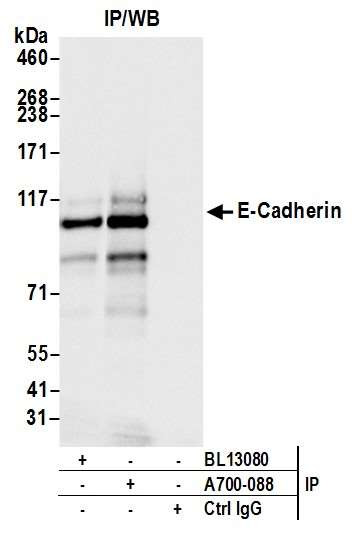 E-Cadherin Antibody in Immunoprecipitation (IP)