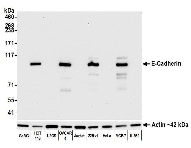 E-Cadherin Antibody in Western Blot (WB)