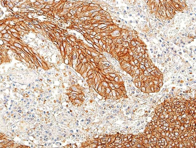 E-Cadherin Antibody in Immunohistochemistry (Paraffin) (IHC (P))