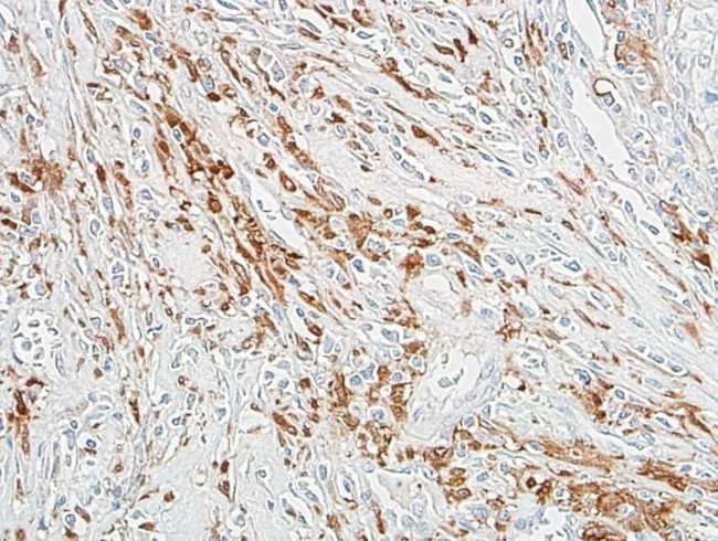 ALDH1A1 Antibody in Immunohistochemistry (Paraffin) (IHC (P))